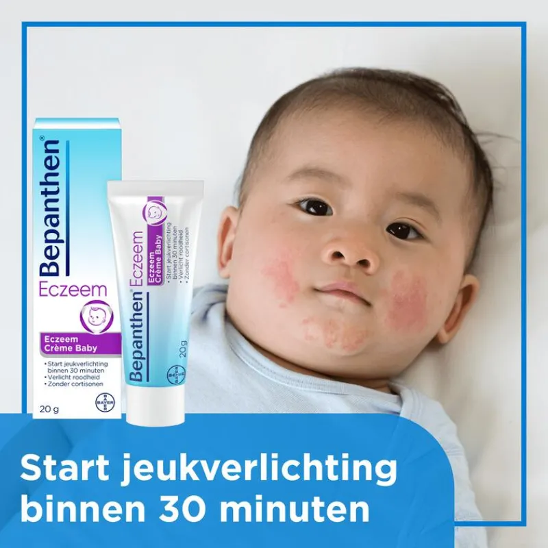 Bepanthen Eczeem Crème Baby Verlicht Jeuk En Roodheid Bij Mild Tot Matig Eczeem 20 GR