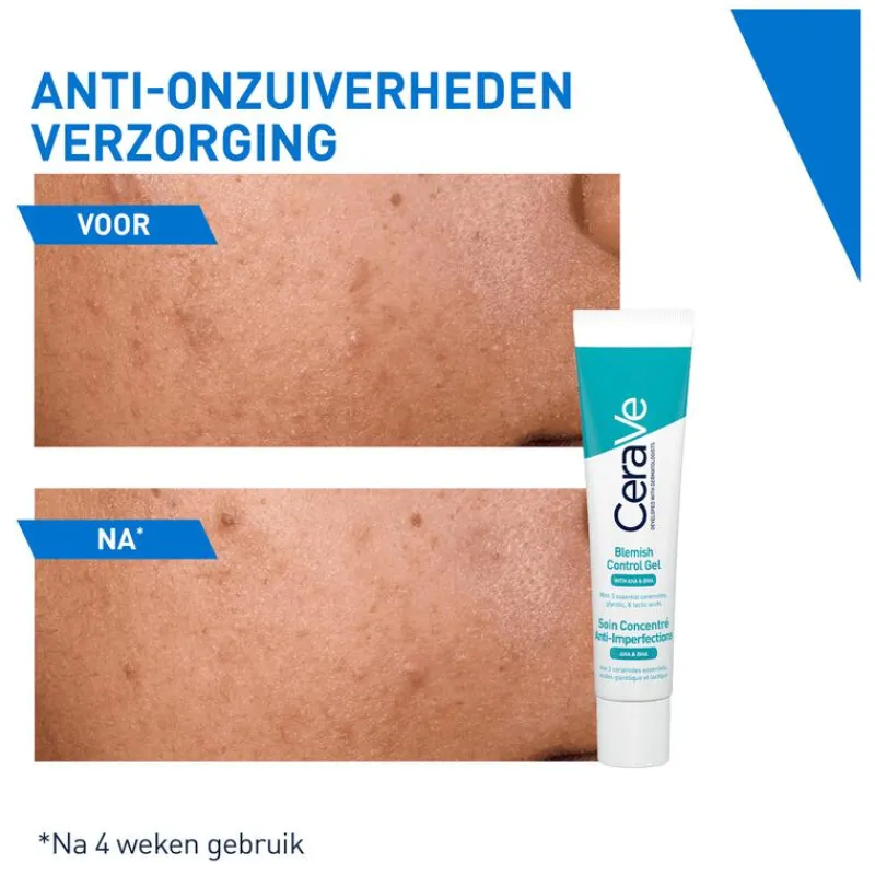 CeraVe Anti-Onzuiverheden Verzorging 40 ML