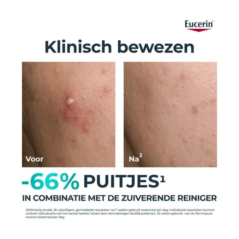 Eucerin DERMOPURE CLINICAL Triple Action Fluid Serum Gevoelige Huid 40 ML