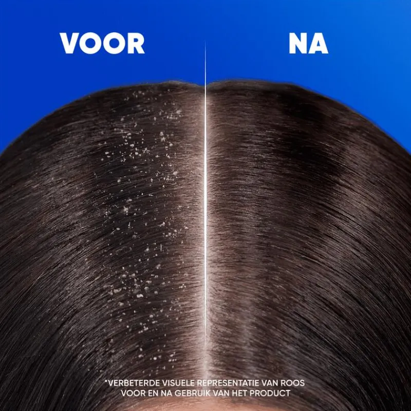 Head and Shoulders Head & Shoulders Citrus Fresh Anti-Roos Shampoo 300 ML