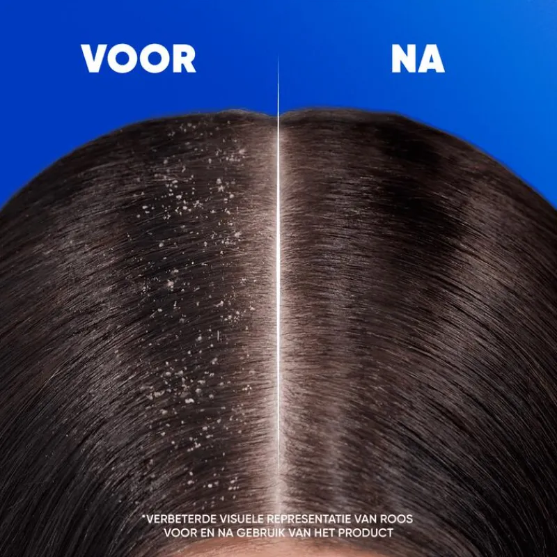 Head and Shoulders Head & Shoulders Sensitive Anti-Roos Shampoo 300 ML
