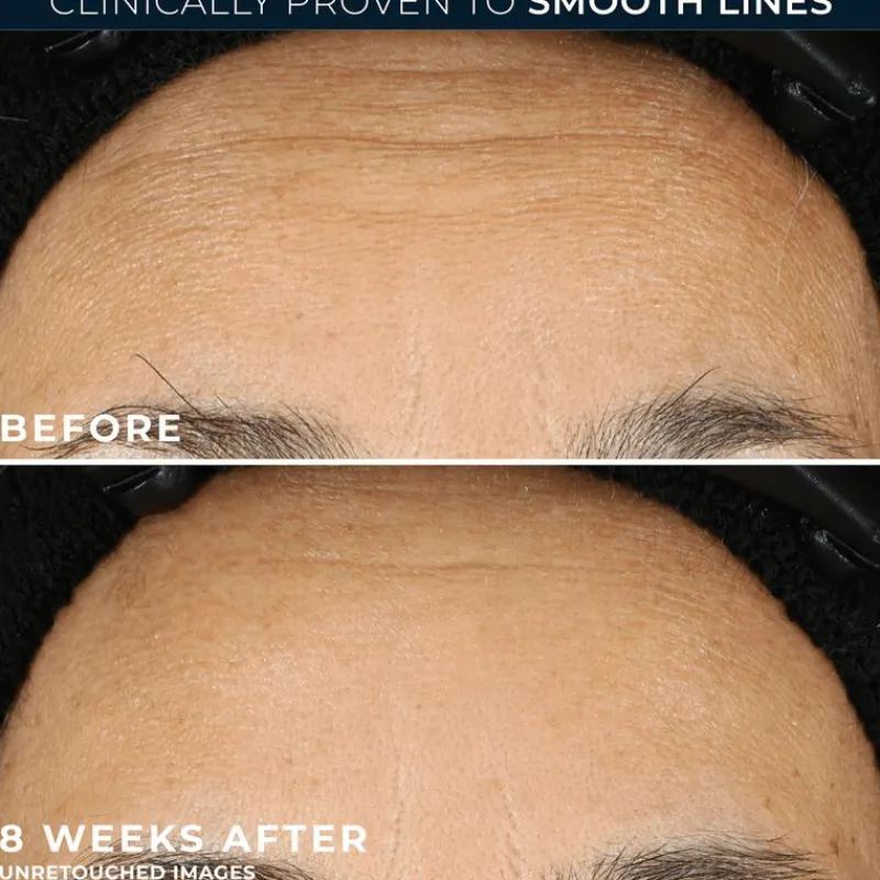 RoC Retinol Correxion Line Smoothing Night Serum 30 capsules