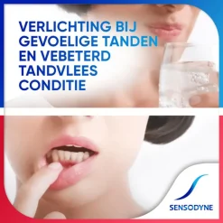 Sensodyne Gevoeligheid & Tandvlees Extra Fresh Tandpasta - 75 ML