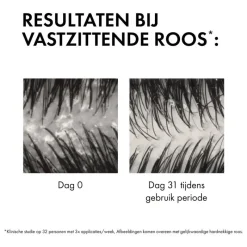 Vichy Dercos Anti-Roos DS Shampoo NH/VH Navulling 390 ML