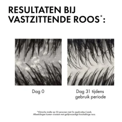 Vichy Dercos Anti-Roos DS Shampoo DH Navulling 390 ML